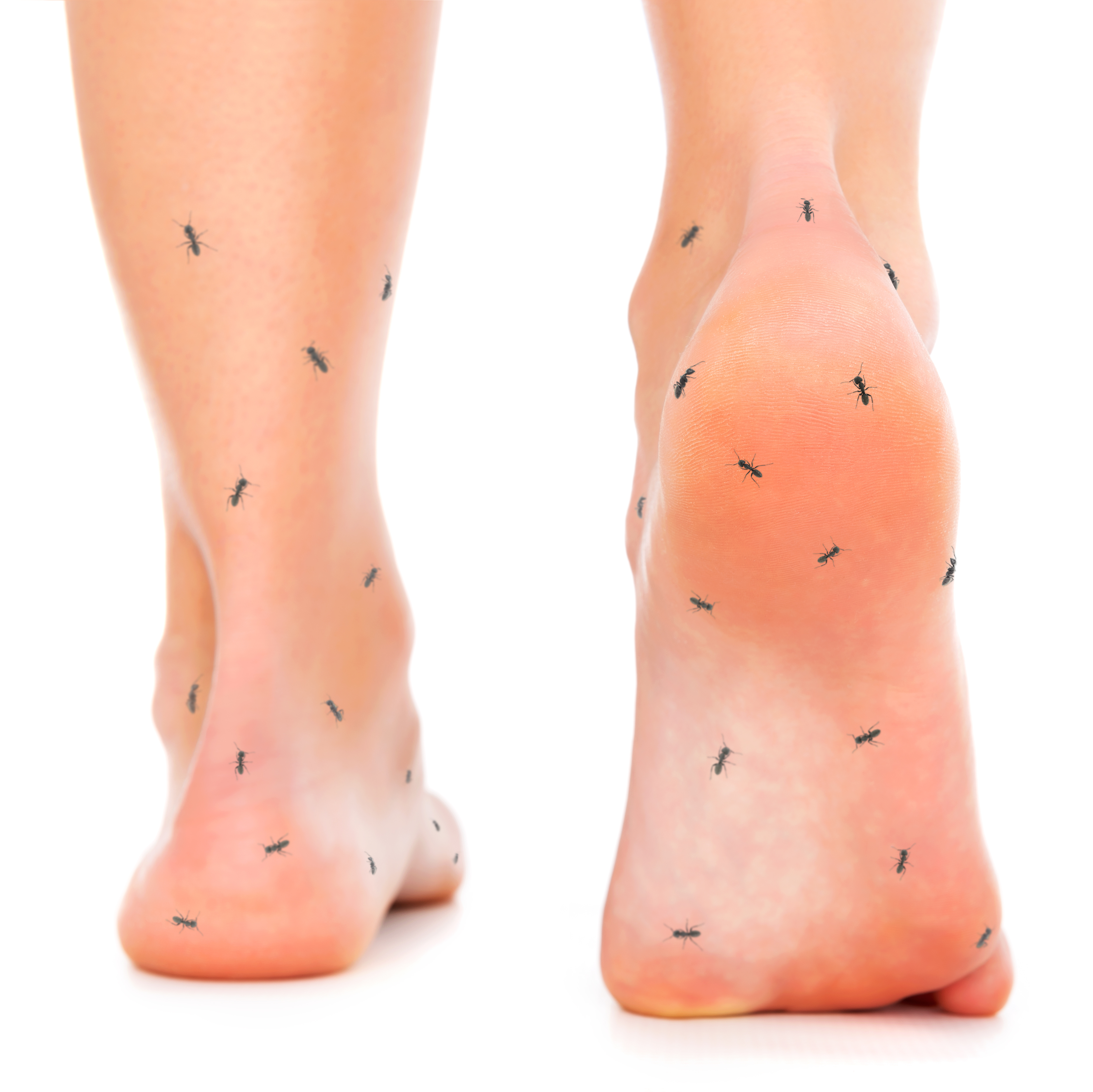 Nackte Füße, auf denen Ameisen herumkrabbeln