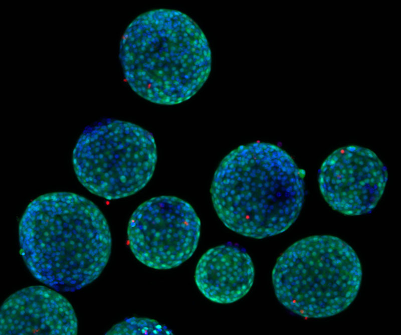 Fluoreszierende Zellen in vergrößerter Ansicht