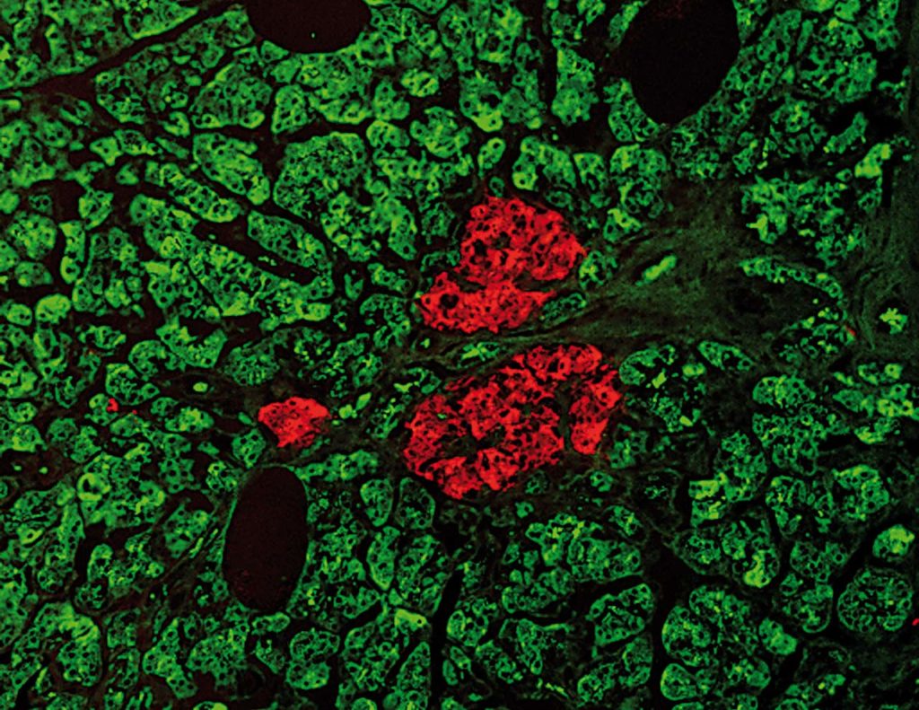 Research Group Islet Cell Research - Deutsches Diabetes-Zentrum (DDZ)